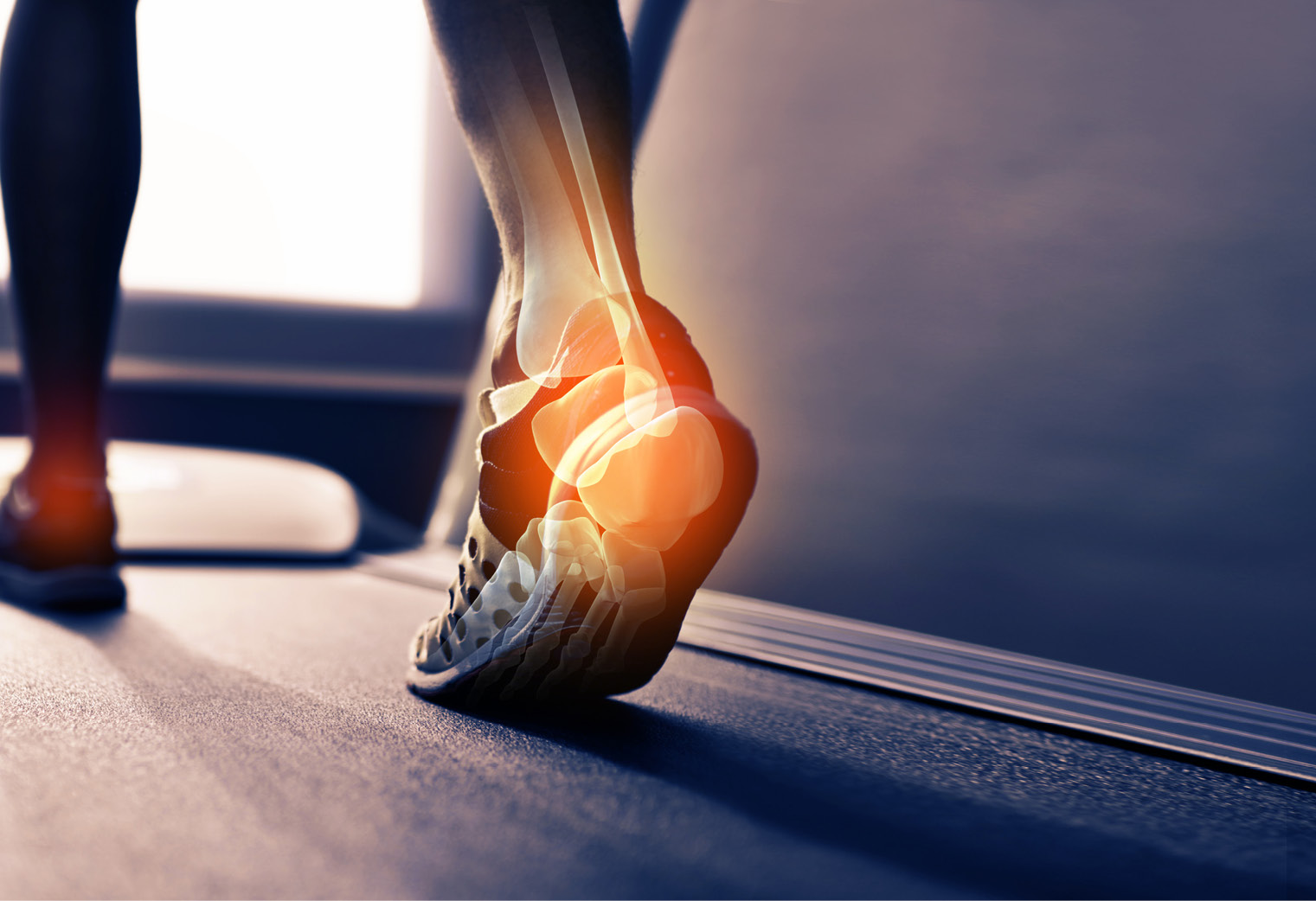 Ankle Sprain: Elite Sports Medicine + Orthopedics: Orthopedics